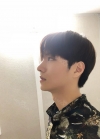 Nose surgery 3 months — Korea cost, reviews & before-after | MISOODA