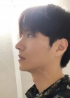 Nose surgery 3 months — Korea cost, reviews & before-after | MISOODA