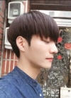Nose surgery 3 months — Korea cost, reviews & before-after | MISOODA