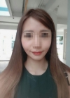3D Zygoma reduction fully worth it! — Korea cost, reviews & before-after | MISOODA