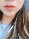 Dual Epi + Nasap Tip Correction + Lip Filler — Korea cost, reviews & before-after | MISOODA