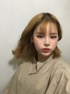 Dual Epi + Nasap Tip Correction + Lip Filler — Korea cost, reviews & before-after | MISOODA