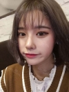 Dual Epi + Nasap Tip Correction + Lip Filler — Korea cost, reviews & before-after | MISOODA