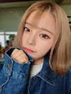 Dual Epi + Nasap Tip Correction + Lip Filler — Korea cost, reviews & before-after | MISOODA