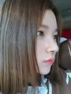 Dual Epi + Nasap Tip Correction + Lip Filler — Korea cost, reviews & before-after | MISOODA