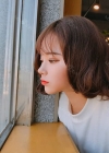 Dual Epi + Nasap Tip Correction + Lip Filler — Korea cost, reviews & before-after | MISOODA