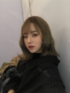 Dual Epi + Nasap Tip Correction + Lip Filler — Korea cost, reviews & before-after | MISOODA