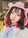 Dual Epi + Nasap Tip Correction + Lip Filler — Korea cost, reviews & before-after | MISOODA