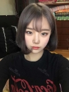 Dual Epi + Nasap Tip Correction + Lip Filler — Korea cost, reviews & before-after | MISOODA