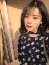 Dual Epi + Nasap Tip Correction + Lip Filler — Korea cost, reviews & before-after | MISOODA