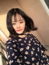 Dual Epi + Nasap Tip Correction + Lip Filler — Korea cost, reviews & before-after | MISOODA