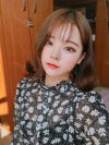 Dual Epi + Nasap Tip Correction + Lip Filler — Korea cost, reviews & before-after | MISOODA