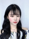 Dual Epi + Nasap Tip Correction + Lip Filler — Korea cost, reviews & before-after | MISOODA