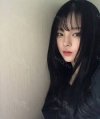 Dual Epi + Nasap Tip Correction + Lip Filler — Korea cost, reviews & before-after | MISOODA