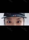 Double eyelids revision only 1 week at Topface! — Korea cost, reviews & before-after | MISOODA