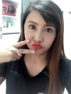 Vline, Cheekbone, Acculift Review at View — Korea cost, reviews & before-after | MISOODA