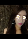 Bye Bye an ugly nose — Korea cost, reviews & before-after | MISOODA