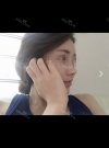 Bye Bye an ugly nose — Korea cost, reviews & before-after | MISOODA
