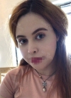 Great service doing Ulthera , Botox and Lip fillers using Misooda — Korea cost, reviews & before-after | MISOODA