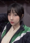 Double Eyelid + Rhinoplasty + Fat Graft + Facial Bone — Korea cost, reviews & before-after | MISOODA