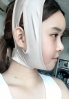 Yepoong-ee’s Plastic Surgery Real Review — Korea cost, reviews & before-after | MISOODA