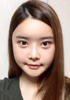 Yepoong-ee’s Plastic Surgery Real Review — Korea cost, reviews & before-after | MISOODA