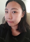 Double Eyelid + Rhinoplasty + Fat Graft + Facial Bone — Korea cost, reviews & before-after | MISOODA