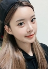Yepoong-ee’s Plastic Surgery Real Review — Korea cost, reviews & before-after | MISOODA