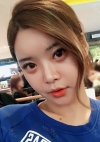 Yepoong-ee’s Plastic Surgery Real Review — Korea cost, reviews & before-after | MISOODA