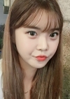 Yepoong-ee’s Plastic Surgery Real Review — Korea cost, reviews & before-after | MISOODA