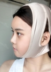 Yepoong-ee’s Plastic Surgery Real Review — Korea cost, reviews & before-after | MISOODA