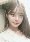 Yepoong-ee’s Plastic Surgery Real Review — Korea cost, reviews & before-after | MISOODA