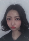 Double Eyelid + Rhinoplasty + Fat Graft + Facial Bone — Korea cost, reviews & before-after | MISOODA