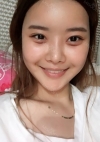 Yepoong-ee’s Plastic Surgery Real Review — Korea cost, reviews & before-after | MISOODA