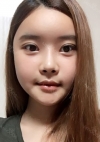 Yepoong-ee’s Plastic Surgery Real Review — Korea cost, reviews & before-after | MISOODA
