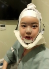 Yepoong-ee’s Plastic Surgery Real Review — Korea cost, reviews & before-after | MISOODA