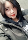 Yepoong-ee’s Plastic Surgery Real Review — Korea cost, reviews & before-after | MISOODA