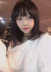 Double Eyelid + Rhinoplasty + Fat Graft + Facial Bone — Korea cost, reviews & before-after | MISOODA