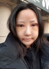 Double Eyelid + Rhinoplasty + Fat Graft + Facial Bone — Korea cost, reviews & before-after | MISOODA
