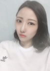 Double Eyelid + Rhinoplasty + Fat Graft + Facial Bone — Korea cost, reviews & before-after | MISOODA