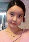 Yepoong-ee’s Plastic Surgery Real Review — Korea cost, reviews & before-after | MISOODA