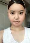 Yepoong-ee’s Plastic Surgery Real Review — Korea cost, reviews & before-after | MISOODA