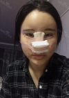 Nose, Eye, Fat inject — Korea cost, reviews & before-after | MISOODA