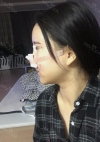 Nose, Eye, Fat inject — Korea cost, reviews & before-after | MISOODA