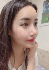 Nose, Fat Grafting — Korea cost, reviews & before-after | MISOODA