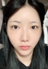Facial Contour, Double Eyelid Surgery in TS PS!! — Korea cost, reviews & before-after | MISOODA