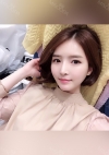 Double eyelids revision & Nose revision :) — Korea cost, reviews & before-after | MISOODA