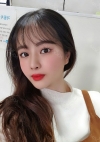 Nose, Eye, Fat Graft After 1 year!!! — Korea cost, reviews & before-after | MISOODA