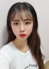 Nose, Eye, Fat Graft After 1 year!!! — Korea cost, reviews & before-after | MISOODA