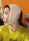 Facial Contour, Double Eyelid Surgery in TS PS!! — Korea cost, reviews & before-after | MISOODA